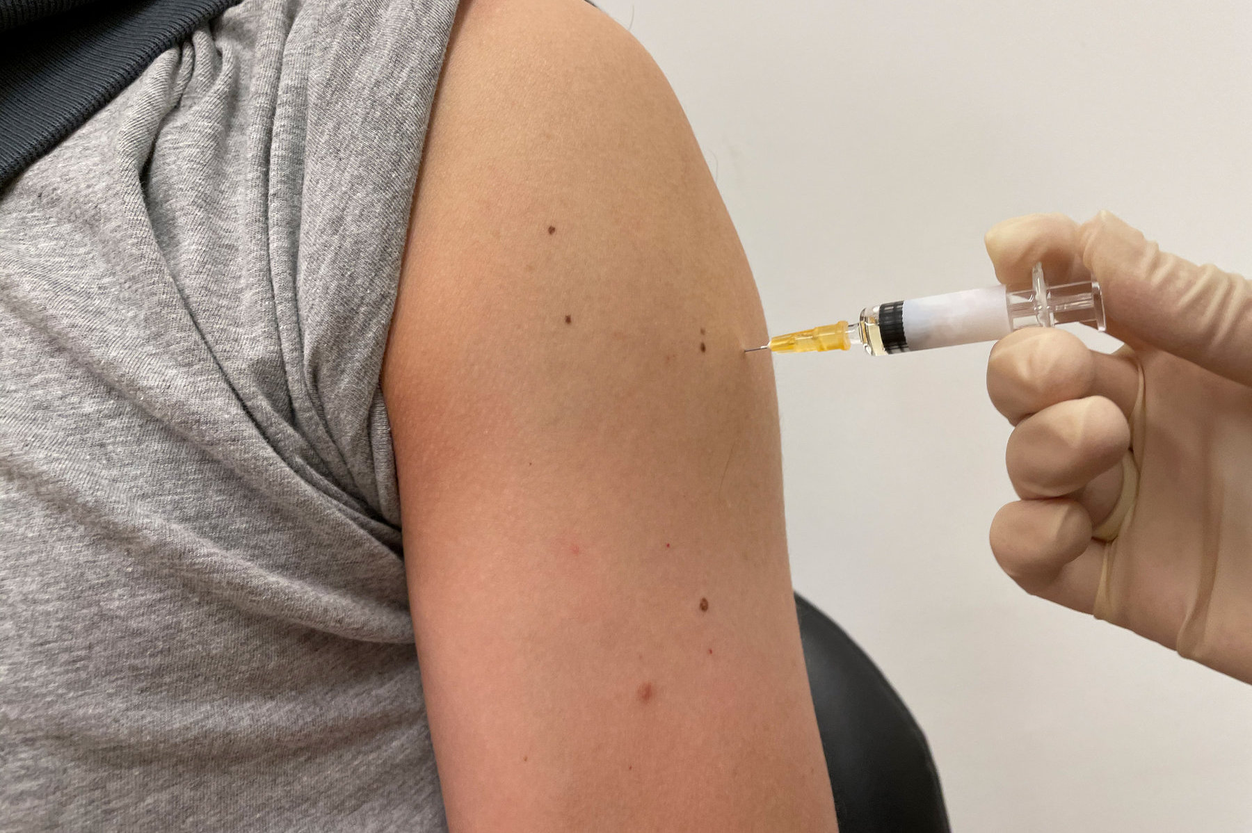 impfung-arm