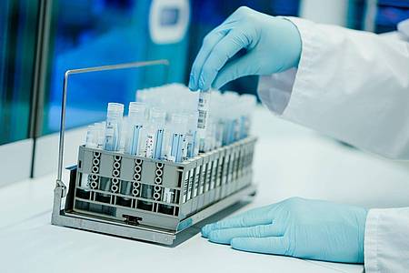 Ein Mitarbeiter eines Heidelberger Coronatest-Labors bereitet PCR-Teströhrchen vor.
