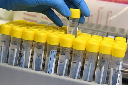 Eine medizinisch-technische Laborassistentin bereitet in einem PCR-Labor die Auswertung von mehreren Corona-Tests vor.