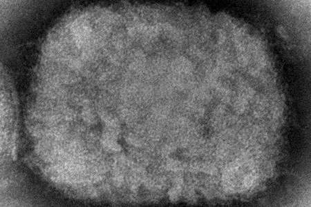 Die elektronenmikroskopische Aufnahme zeigt ein Affenpockenvirus.